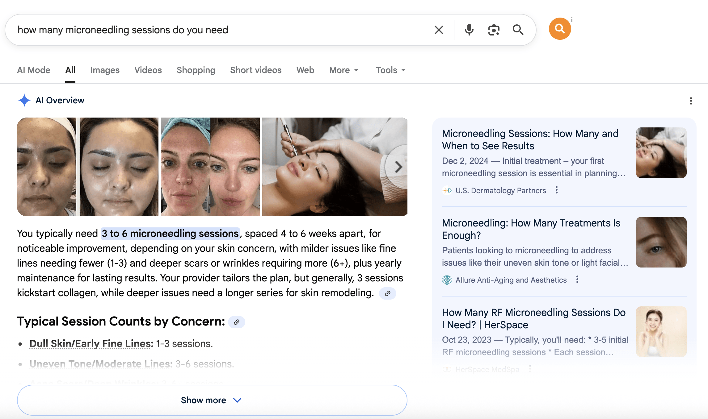 question that can be answered by content marketing